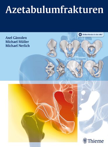 ﻿شکستگی استابولوم