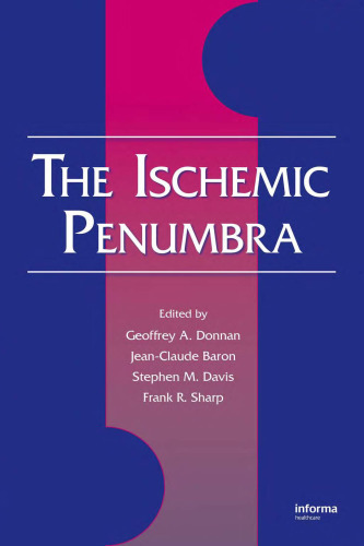 Ischemic Penumbra (بیماری عصبی و درمانی)