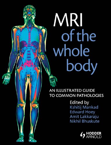 ﻿ام آر آی کل بدن. راهنمای مصور آسیب شناسی های رایج