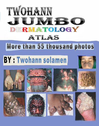 ﻿اطلس پوست TWOhann jumbo