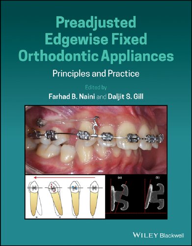 ﻿لوازم ارتودنسی ثابت Edgewise Preadjusted Edgewise Fixed Orthodontic Appliances: Principles and Practice