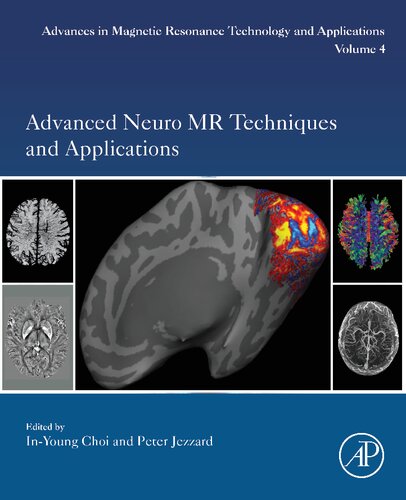 ﻿تکنیک ها و کاربردهای پیشرفته Neuro MR (جلد 4) (پیشرفت ها در فناوری و برنامه های رزونانس مغناطیسی، جلد 4)