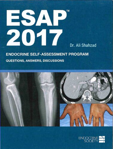 ﻿ESAP™ 2017 برنامه خودارزیابی غدد درون ریز پرسش ها و پاسخ ها بحث ها انجمن غدد درون ریز