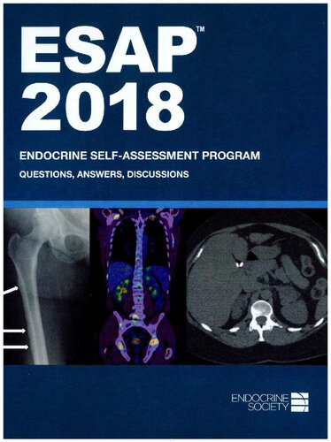 ﻿ESAP™ 2018 برنامه خودارزیابی غدد درون ریز پرسش و پاسخ بحث ها انجمن غدد درون ریز