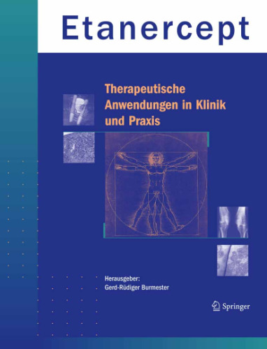 Etanercept - Therapeutische Anwendung در Klinik und Praxis