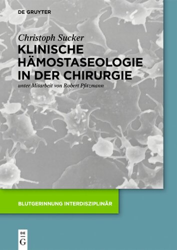 ﻿Klinische Hämostaseologie in der Chirurgie