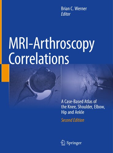 ﻿MRI-Arthroscopy Correlations اطلسی مبتنی بر مورد زانو، شانه.