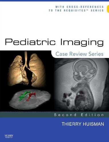 ﻿تصویربرداری کودکان: سری بررسی موردی