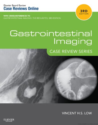 ﻿Gastrointestinal Imaging: Case Review Series: Case Review Series