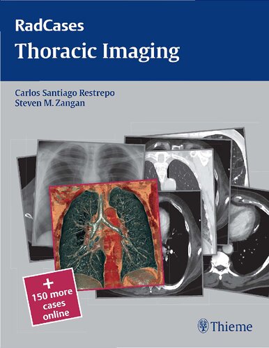 ﻿Radcases Toracic Imaging (Radcases Plus Q