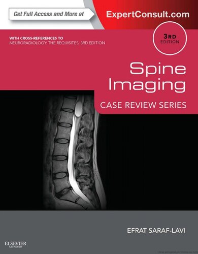 ﻿Spine Imaging: Case Review Series