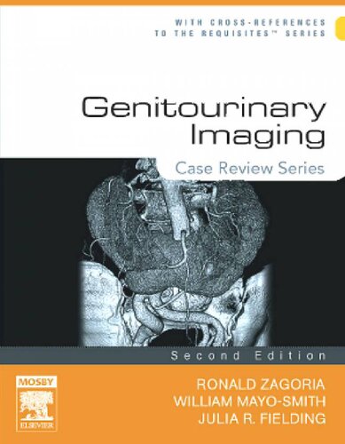 ﻿تصویربرداری ادراری تناسلی: سری بررسی موردی