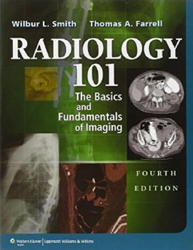﻿رادیولوژی 101: اصول اولیه