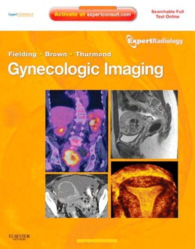 ﻿Gynecologic Imaging: Expert Radiology Series (Expert Consult Edition Premium - Enhanced Online Features and Print), 1e