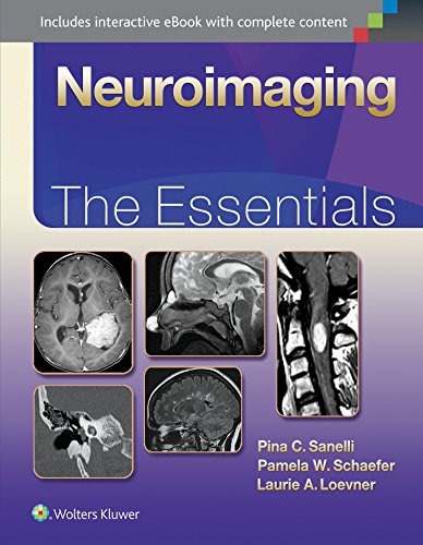 ﻿Neuroimaging: The Essentials (سری Essentials)