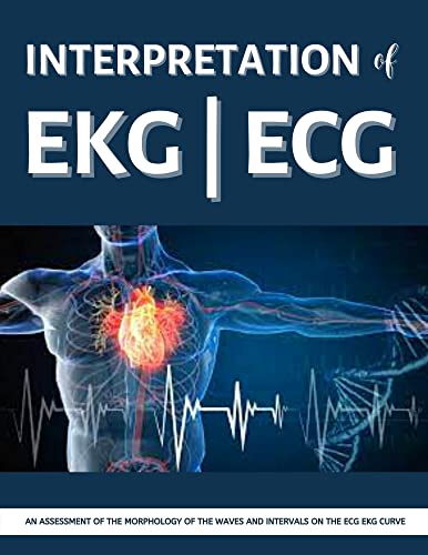 ﻿تفسیر EKG | ECG: راهنمای عملی مصور برای پزشکان، کارورزان، دانشجویان پزشکی یا هر کسی که در حرفه مراقبت های بهداشتی است تا به راحتی یاد بگیرند که چگونه نوارهای EKG را بخوانید و تفسیر کنید.