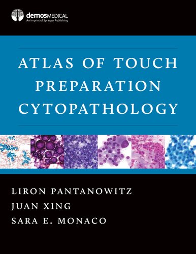 ﻿Atlas of Touch Preparation Cytopathology توسط Springer، Liron Pantanowitz، MD / Juan Xing، MD / Sara E. Monaco، MD