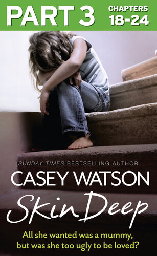 ﻿پوست عمیق، قسمت 3 از 3: تنها چیزی که او می خواست یک مومیایی بود، اما آیا او آنقدر زشت بود که دوست نداشت؟