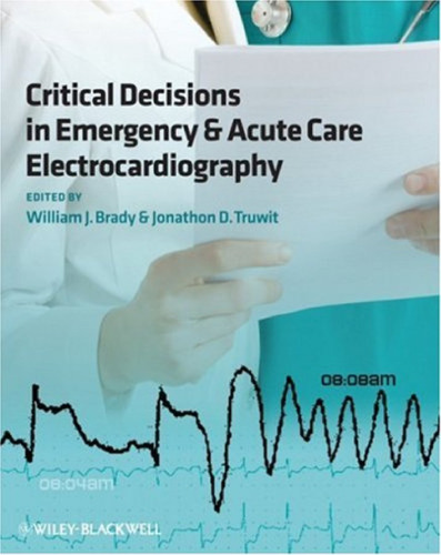 Critical Decisions in Emergency and Acute Care  Electrocardiography
