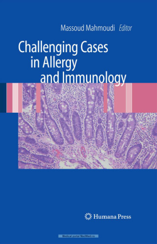 ﻿موارد چالش برانگیز در آلرژی و ایمونولوژی