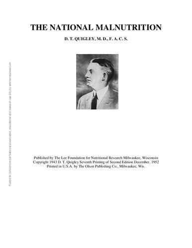 ﻿سو تغذیه ملی