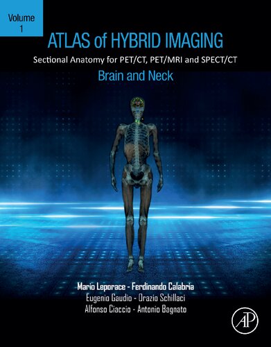 ﻿Atlas of Hybrid Imaging Sectional Anatomy for PET/CT, PET/MRI and SPECT/CT Vol. 1: مغز و گردن: آناتومی مقطعی برای PET/CT، PET/MRI و SPECT/CT
