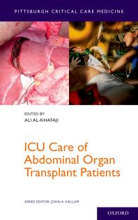 ﻿مراقبت ICU از بیماران پیوند عضو شکمی