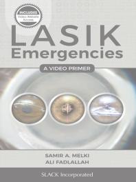 ﻿اضطراری Lasik: آغازگر ویدئویی