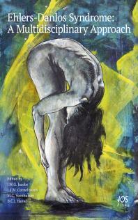 ﻿سندرم اهلرز-دانلوس: یک رویکرد چند رشته ای