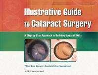 ﻿راهنمای تصویری برای جراحی آب مروارید: رویکردی گام به گام برای اصلاح مهارت های جراحی