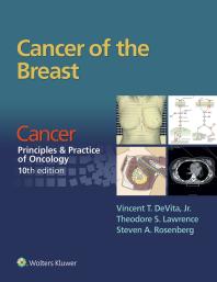 ﻿Cancer of the Breast: From Cancer: Principles and Practice of Oncology، ویرایش دهم