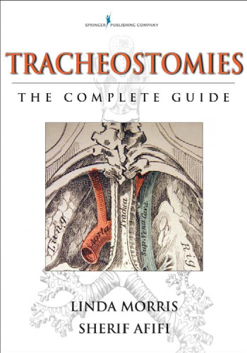 Tracheostomies: راهنمای کامل