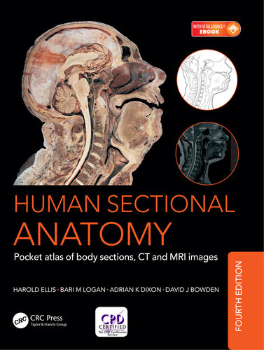 ﻿Human Sectional Anatomy: Pocket Atlas of Body Sections, CT and MRI Images, Fourth Edition