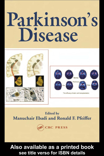 بیماری پارکینسون