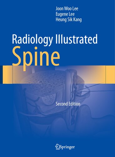 ﻿Radiology Illustrated-Spine, 2e (24 دسامبر 2023)_(9819966116)_(اسپرینگر)