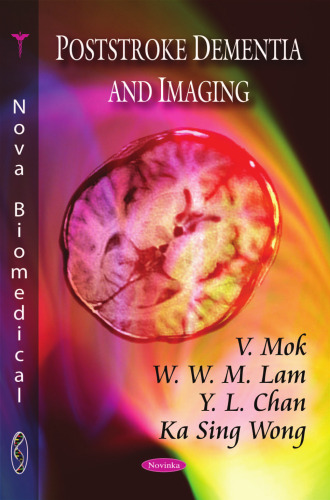 ﻿زوال عقل و تصویربرداری پس از سکته مغزی