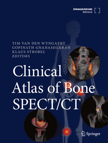 ﻿اطلس بالینی استخوان SPECT/CT
