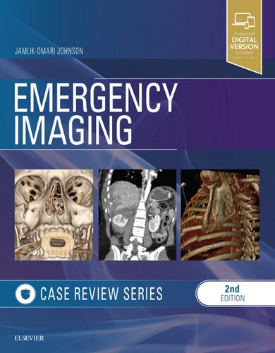 ﻿Emergency Imaging: Case Review Series