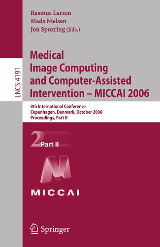﻿محاسبات تصویر پزشکی و مداخله به کمک رایانه-Miccai 2006: نهمین کنفرانس بین المللی ، کپنهاگ ، دانمارک ، 1-6 اکتبر 2006 ، مجموعه مقالات