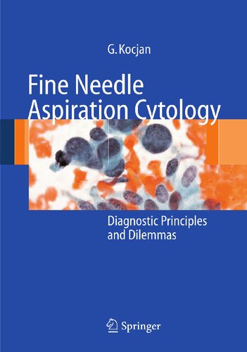 ﻿سیتولوژی آسپیراسیون سوزن ریز: اصول تشخیصی و معضلات