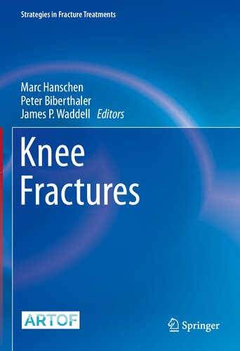 ﻿شکستگی زانو (استراتژی در درمان شکستگی)