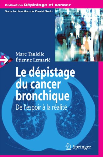 ﻿Le dépistage du Cancer bronchique: de l'espoir à la réalité (Dépistage et cancer) (نسخه فرانسوی)