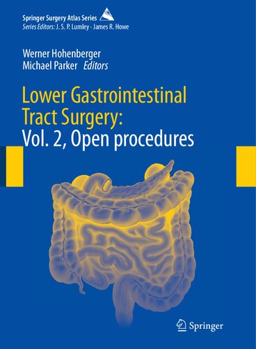 ﻿Lower Gastrointestinal Tract Surgery: Vol. 2، روش های باز (سری اطلس جراحی اسپرینگر)
