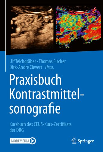 ﻿Praxisbuch Kontrastmittelsonografie: Kursbuch des CEUS-Kurs-Zertifikats der DRG (نسخه آلمانی)