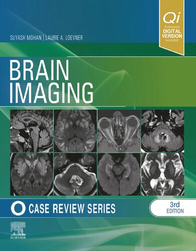 ﻿Brain Imaging - Case Review Series, 3e (4 دسامبر 2023)_(1455774855)_(Elsevier)