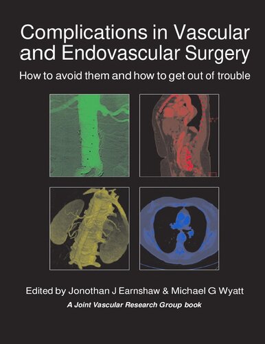 ﻿عوارض در جراحی عروق و اندوواسکولار - چگونه از آنها اجتناب کنیم و چگونه از مشکل خلاص شویم (1 دسامبر 2012)_(190337880X)_(TFM Publishing Ltd)