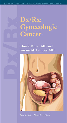 ﻿Dx Rx: سرطان زنان (Jones and Bartlett Publishers Dx Rx Oncology Series)