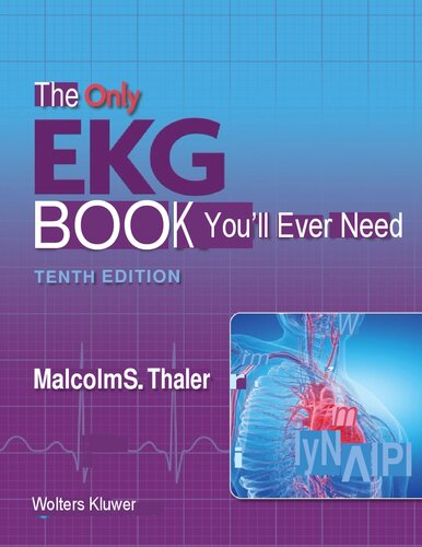 ﻿تنها کتاب EKG که همیشه به آن نیاز خواهید داشت