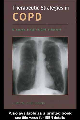 ﻿استراتژی های درمانی در COPD