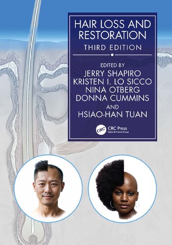 ﻿ریزش مو و ترمیم